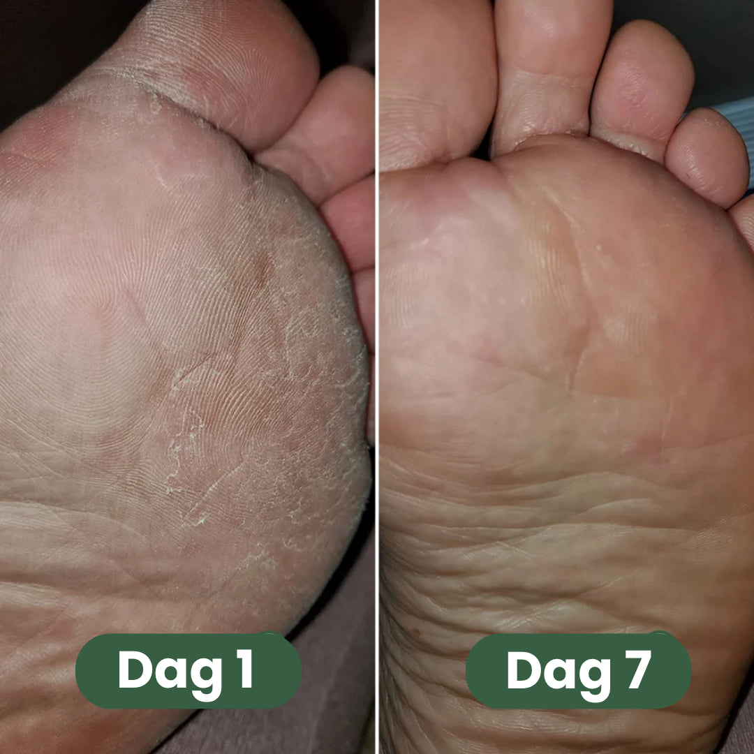 Pedoria™ | Fotvål för fräscha, rena & välvårdade fötter