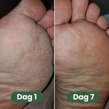Pedoria™ | Fotvål för fräscha, rena & välvårdade fötter