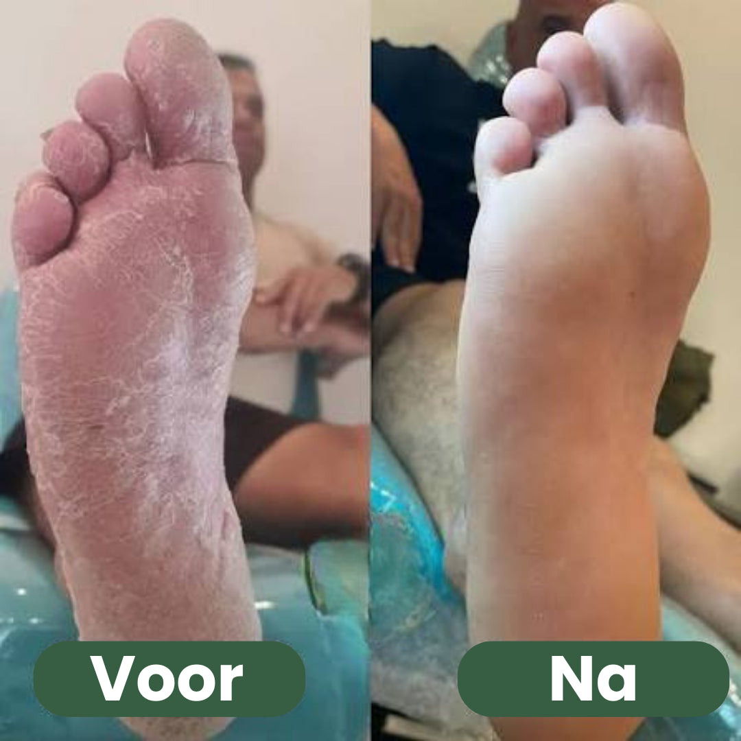 Pedoria™ | Fotvål för fräscha, rena & välvårdade fötter