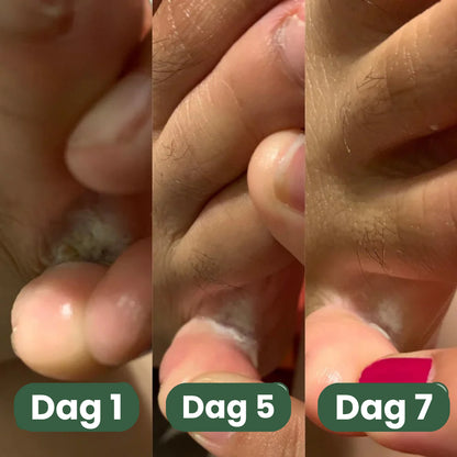 Pedoria™ | Fotvål för fräscha, rena & välvårdade fötter